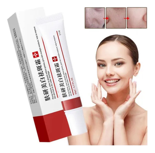 Creme Milagroso Pomada Tira Manchas Espinhas Melasma - 20g Todo Tipo De Pele Dia/noite