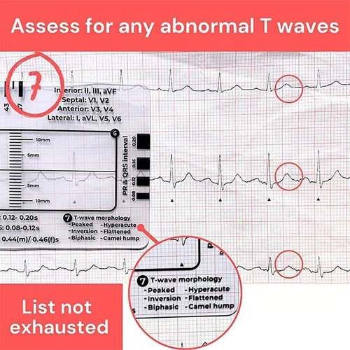 Regla Ecg De 7 Pasos De 2 Piezas, Regla De Ecg De 7 Pasos Pa