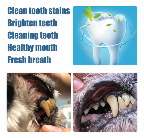3 Bolígrafos Blanqueadores Y Limpiadores De Dientes Para Per