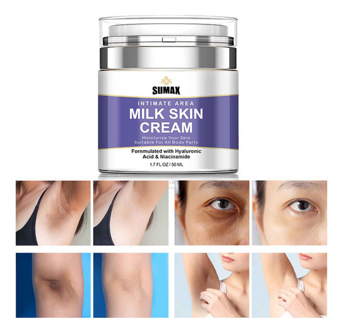 Crema Reparadora De Manchas Oscuras En Forma De V, Crema Par