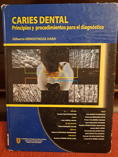 Caries Dental Principios Y Procedimientos Para El Diagnóstic