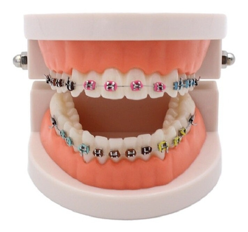 Modelo Dental Brackets Para Estudio Y Práctica Ortodoncia