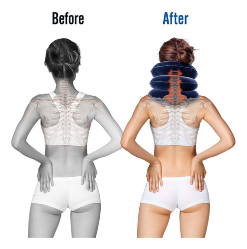 Colar De Tração Cervical Massageador Para Pescoço Azul-escuro Fix