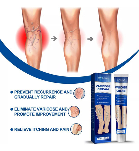 . 3 Peças Varicose Creme -aranha Creme De Veia Varicosa 20g