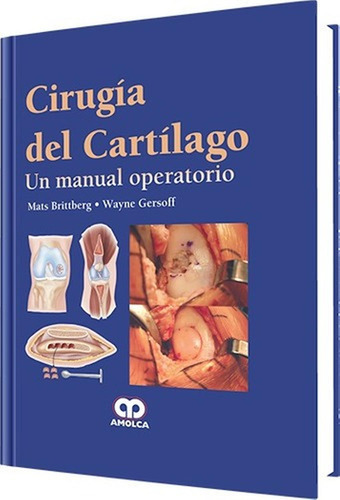 Cirugía Del Cartílago Un Manual Operatorio