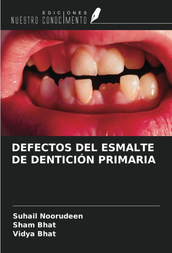 Libro: Defectos Del Esmalte De Dentición Primaria (spanish E