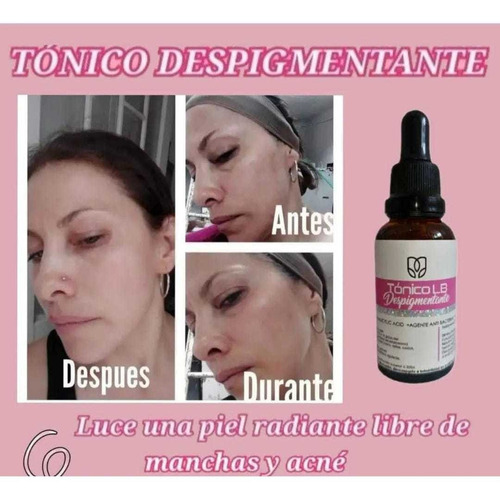 Tonico Despigmentante Aclaran*1 - L A Tipo De Piel Todo Tipo De Piel