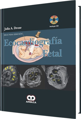 Ecocardiografía Fetal + Dvd 2ª Ed Drose Amolca