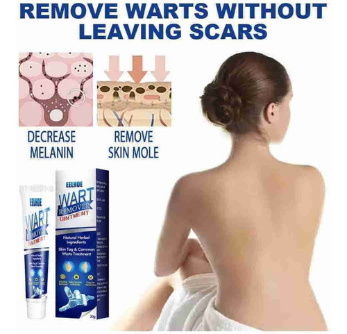 2* Pomada Cremosa Anti-verrugas, Creme Anti-sardas, Removedo