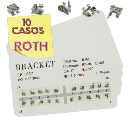 Brackets Ortodoncia Mbt  10 Casos