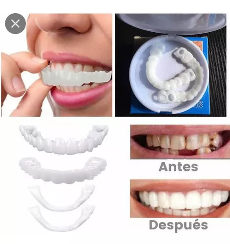 Dientes Postizos Temporal Sonrisa Dental Carilla Estetica F