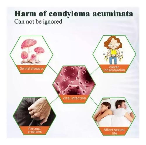 Uma Pomada Anti-verrugas Para Remover Verrugas E Calosidades