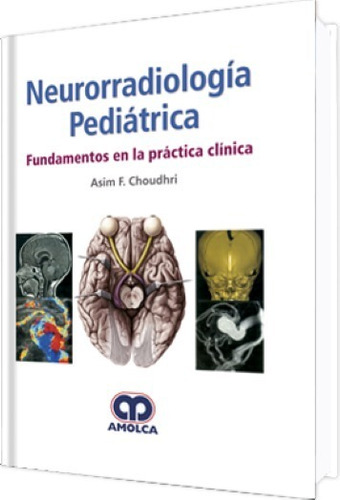 Neurorradiología Pediátrica Fund, En La Práctica Clínica