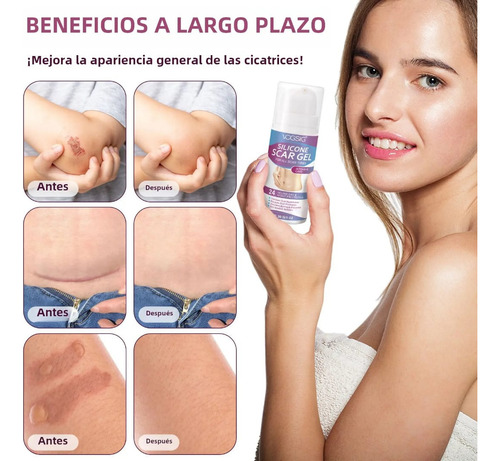 Scar Gel Vogsig Elimina Cicatrices Queloide Abdominoplastia