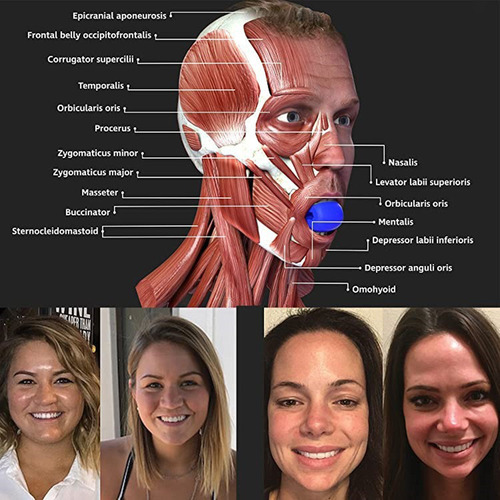 Imagen 2 de 6 de Ejercitador De Mandíbula, Cara Y Cuello, Ejercitador Facial