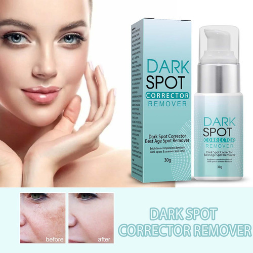 Crema Correctora E Antimanchas Para Rostro Y Cuerpo Age S