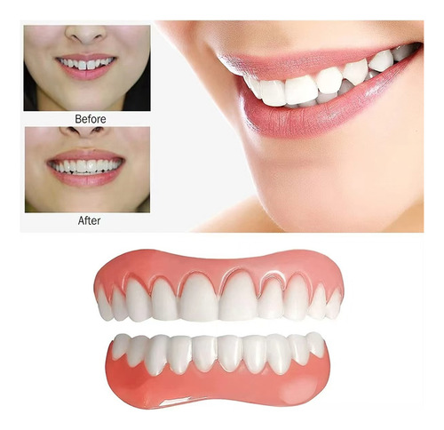 Aparatos Dentales Simulados Instantsmile
