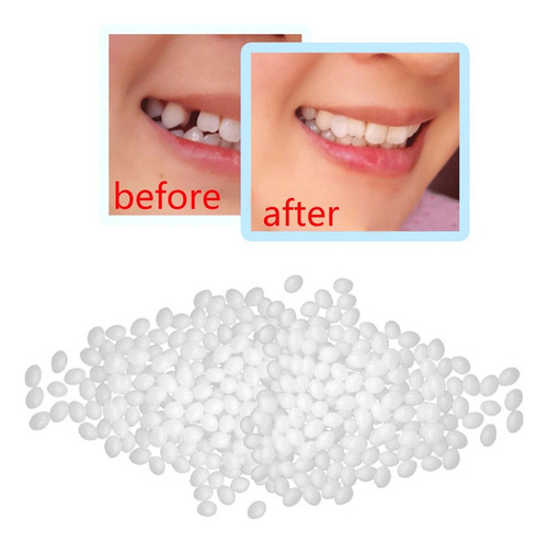 Kit De Reparo De Adesivo Para Dentaduras Com Cola Temporária