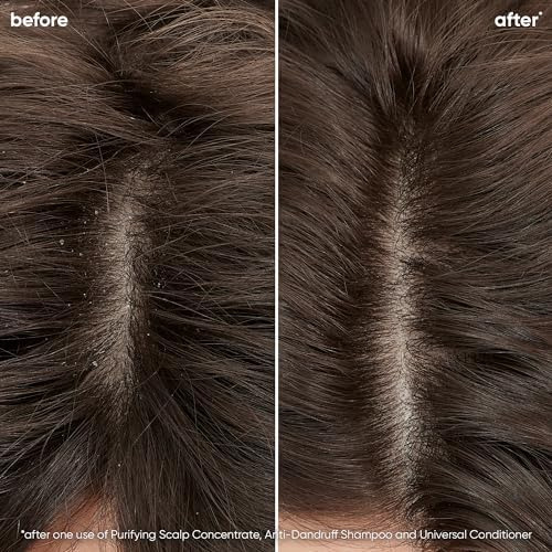 Champú Anticaspa Biolage Scalp Sync | Se Dirige A La Caspa,