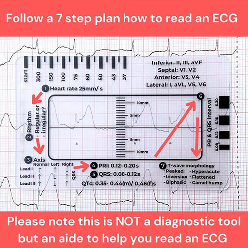 Régua De 7 Etapas De Ecg De 2 Peças, Régua De 7 Etapas De Ec