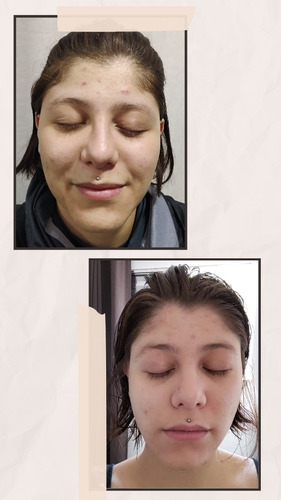 Imagem 1 de 1 de Tratamentos Faciais