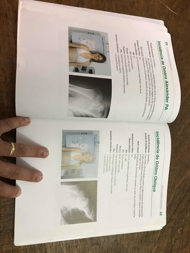Imagem 2 de 7 de Posicionamento Em Radiologia - Editora Corpus