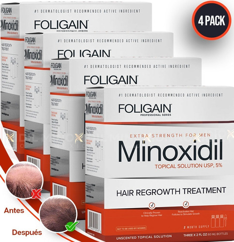 Foligain Minoxidil 5% Solución Tópica 12 Meses