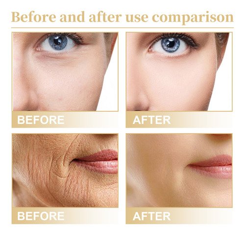 Tónico Facial I Face Toner Anting Arrugas Reafirmante Diluid