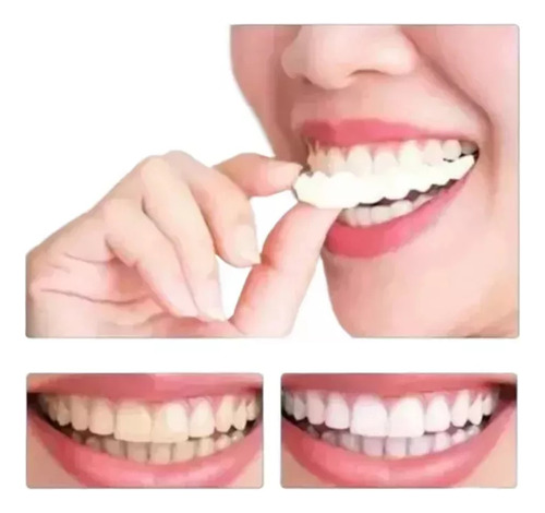 Sorriso Dentes Falsos Folheados W En La Parte Superior/infer
