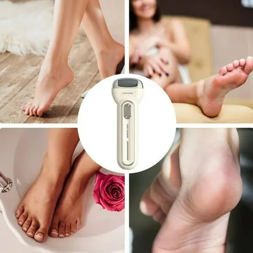 Exfoliador Removedor Callos Pies Usb Inalambrico 3 Cabezales | MercadoLibre