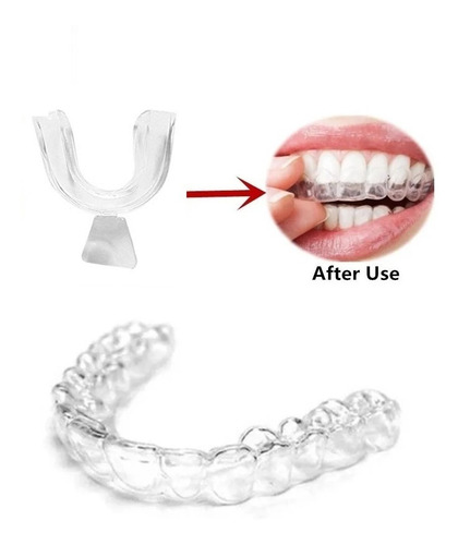 Imagen 2 de 4 de 4 Guarda Dental Bruxismo Guardas Dentales Retenedores Dental
