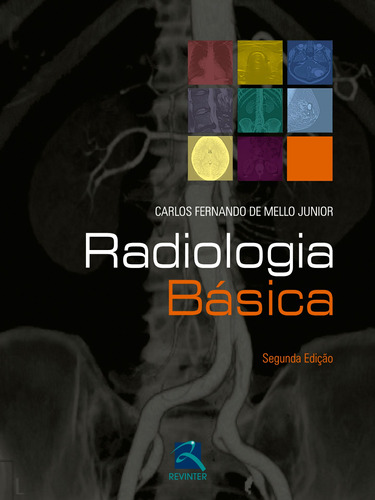 Radiologia Básica, de Mello Junior, Carlos. Editora Thieme Revinter Publicações Ltda, capa dura em português, 2016