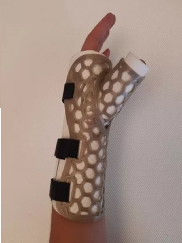 Ferula Yeso Plastico Honey Para Mano Pulgar Termomoldeable