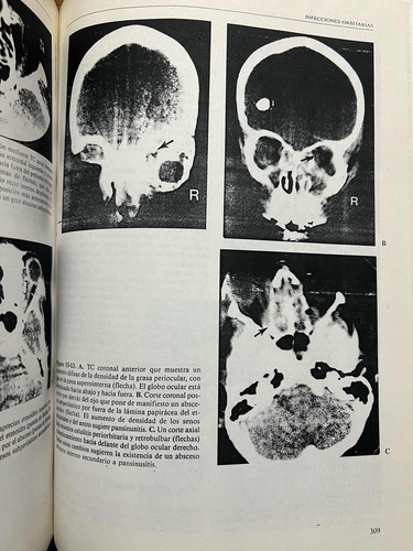 Diagnostico Por Imagen En Oftalmologia, Gonzalez. (copias) (Usado)