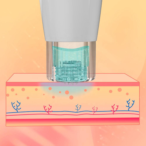 Hydrapen H2 By Dr Pen