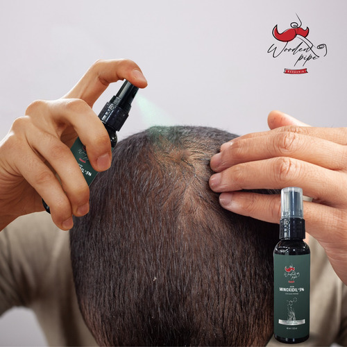 Loción Con Minoxidil Al 5% Anticaída 60ml C/u (3 Piezas)
