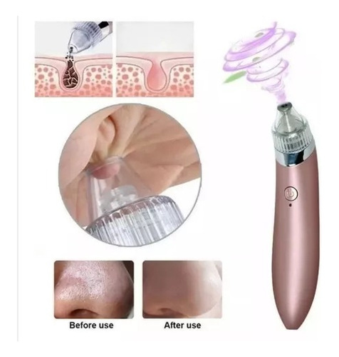 Limpiador Facial Extractor