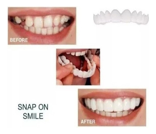 1 Par De Dentaduras Postizas Artificiales De Silicona