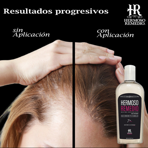 Imagen 5 de 9 de Shampoo Anticaida Crecimiento Reparador Frizz Mujer 7 En 1