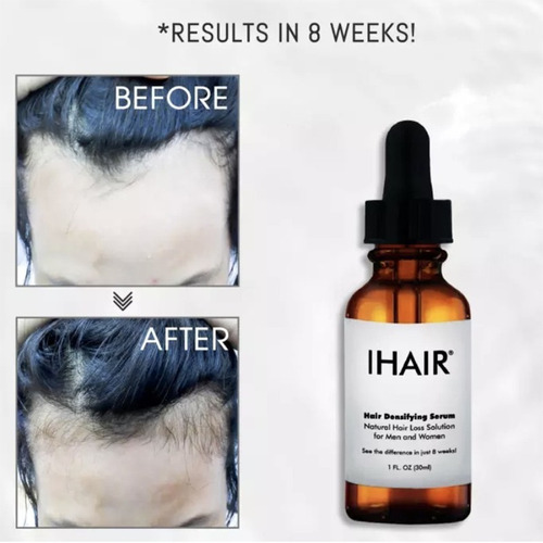 Imagen 7 de 10 de Aceite Esencial Crecimiento Barba Y Bigotes 30ml Super 8