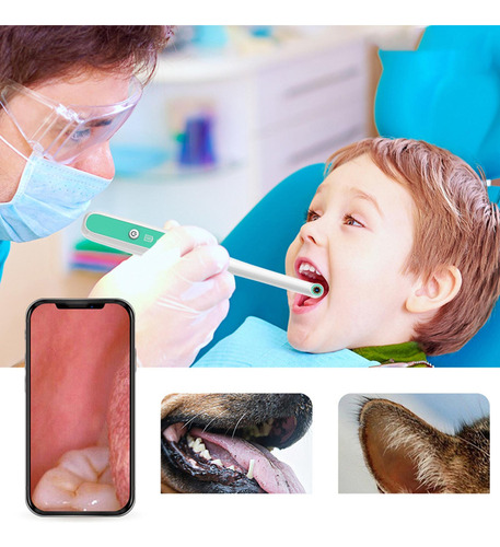 Cámara Intraoral Inalámbrica Brillo Ajustable Endoscopio