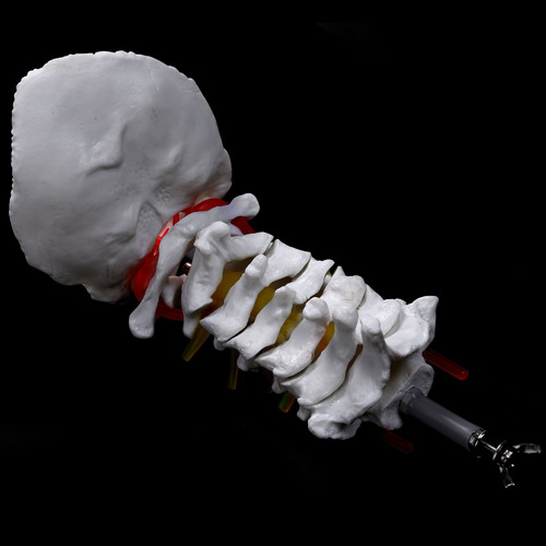 Vertebra Cervical, Arteria, Columna Vertebral, Nervios Espin