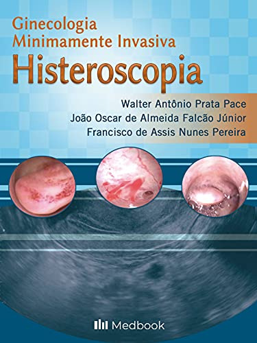 Libro Histeroscopia Ginecologia M Invasiva 01ed 21 De Pace