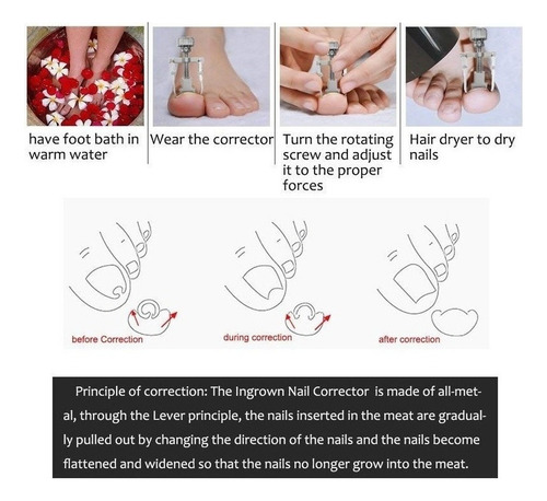Kit Alicates Pedicura Uñas Enterradas Empujador De Cuticula