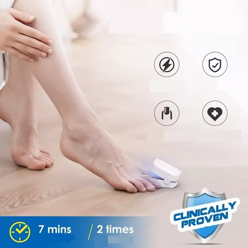 Dispositivo Láser Para Hongos En Las Uñas De Los Pies