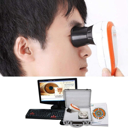Cámara De Iridología Usb 5mp Con Software Pro Y Lente 30x
