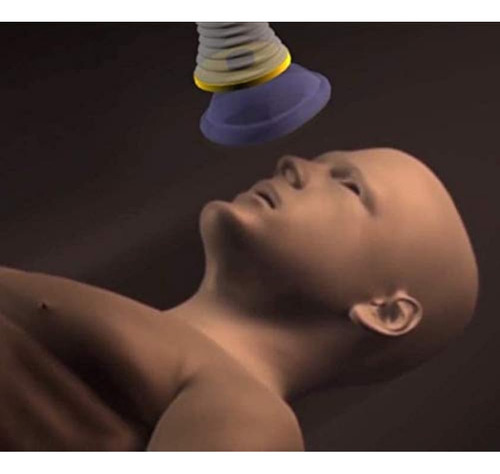 Lifevac - Dispositivo De Rescate De Asfixia Kit Casero Para