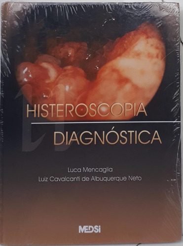 Livro Histeroscopia Diagnóstica - Luca Mencaglia E Luiz Cavalcante De Albuquerque Neto [2001]
