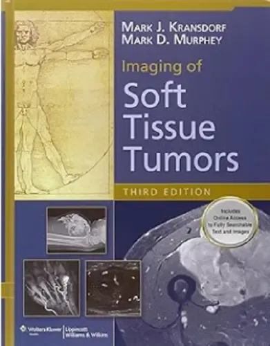 Imaging Of Soft Tissue Tumors - Lww | Frete grátis