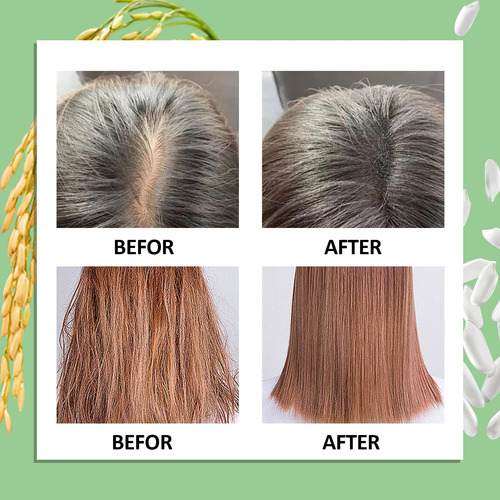 Spray Para El Crecimiento Del Cabello Wozutunt Rice Water 24